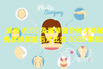 漳州 🐅 兔唇修复价格大揭秘(兔唇修复前后对比效 🐋 果图片及恢复过)